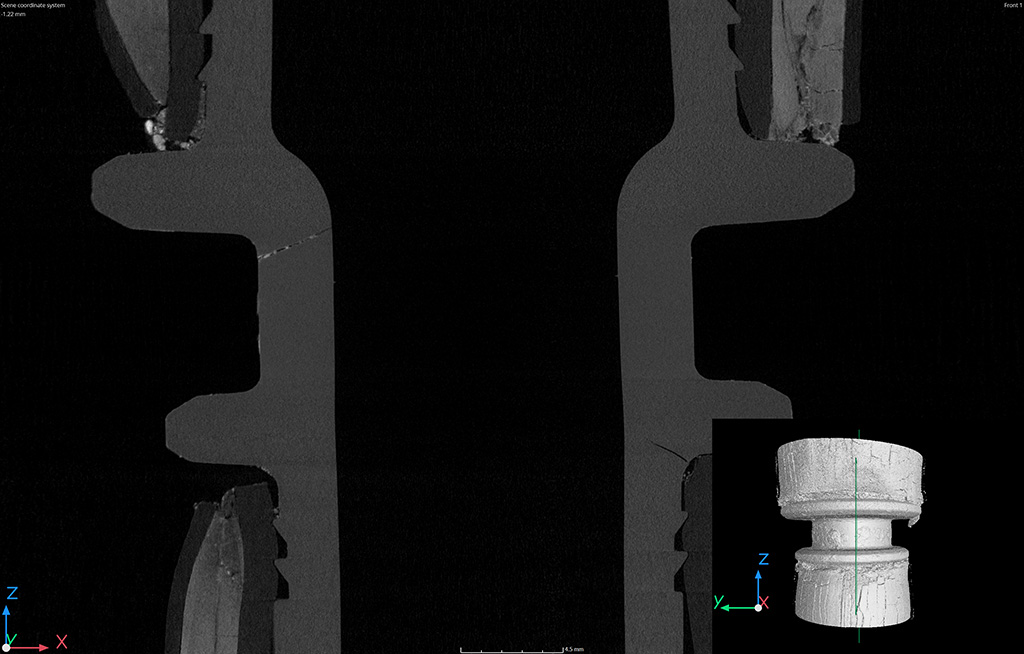 Immagine tomografica, vista laterale del raccordo con rottura